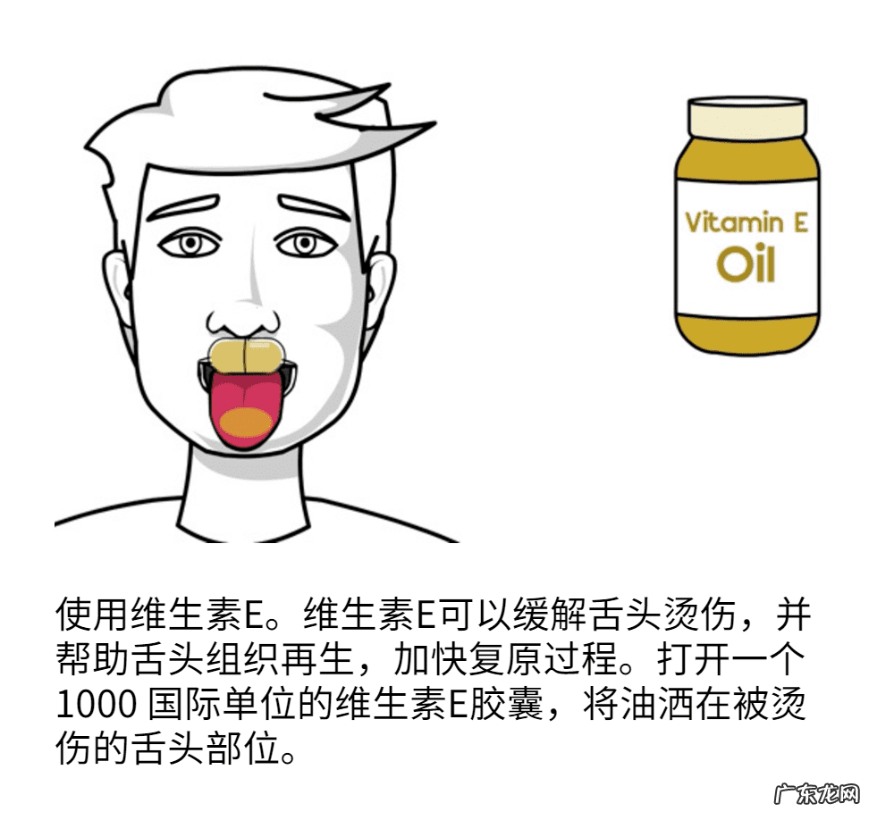 嘴巴舌头烫伤了怎么办 舌头烫伤该怎么办