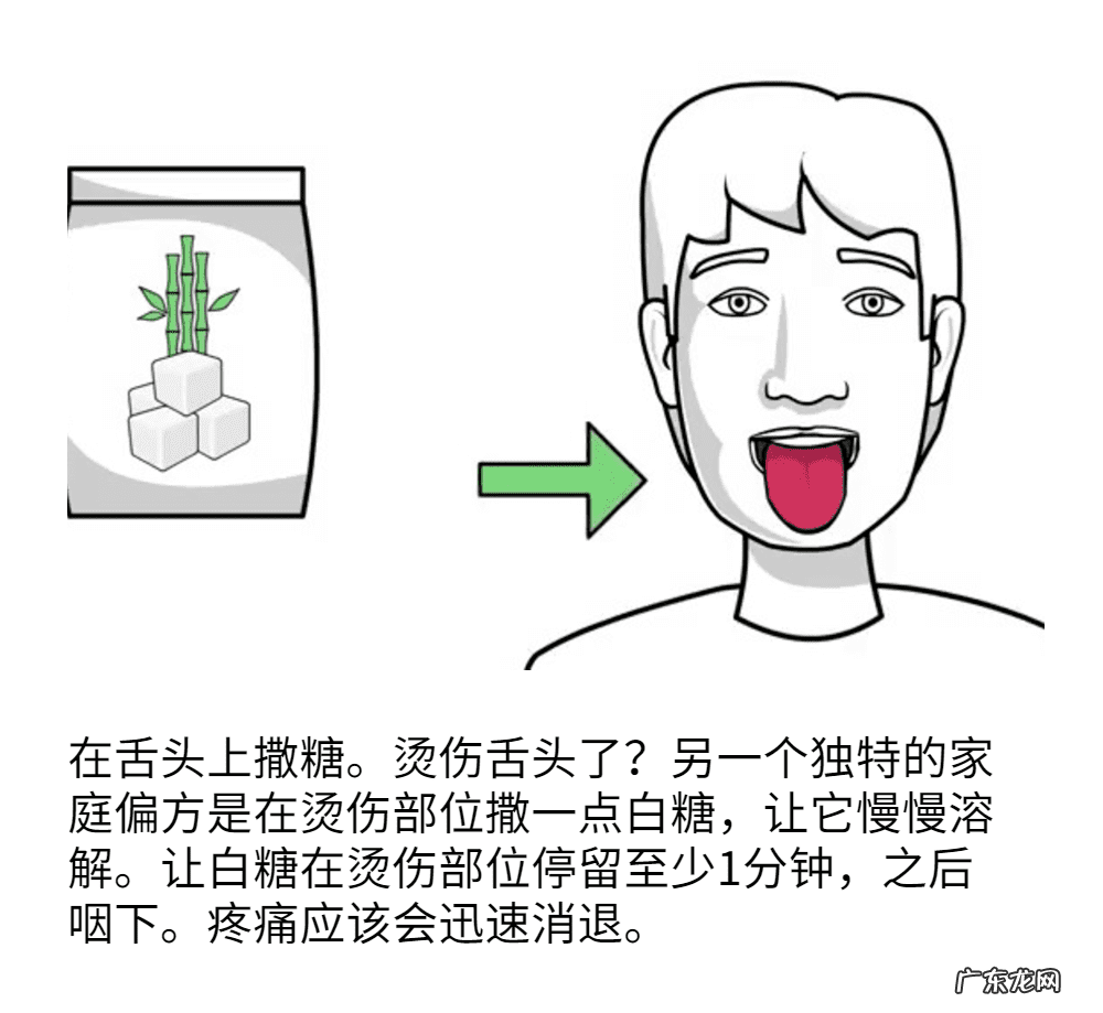 嘴巴舌头烫伤了怎么办 舌头烫伤该怎么办