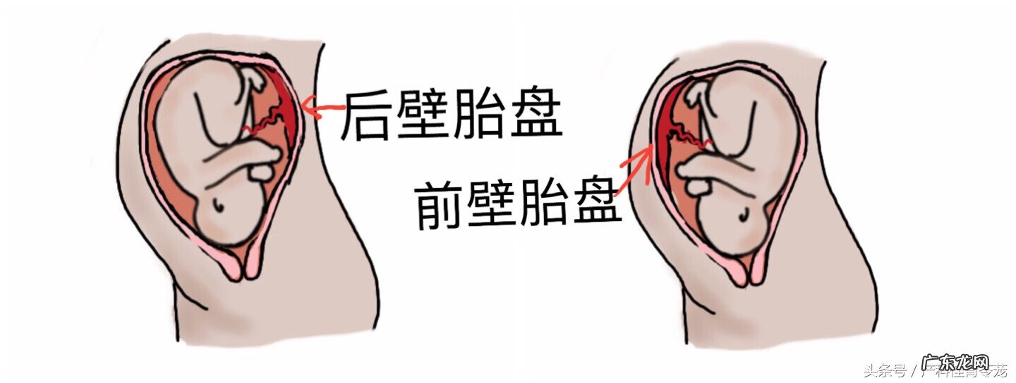 企业bpd是什么意思 bpd是什么意思?