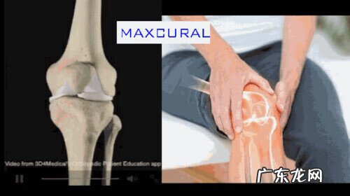 膝盖特别冷 膝盖冷是什么问题