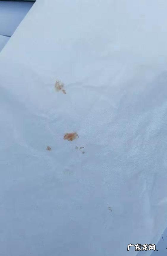 打耳洞红肿发炎 打耳洞发炎肿了,怎么弄,有效方法