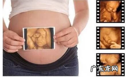 做四维彩超 思维彩超