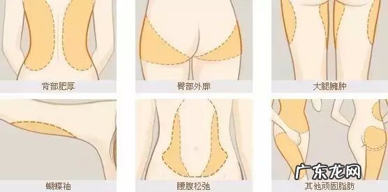 橘皮纹是什么意思 橙皮纹是什么