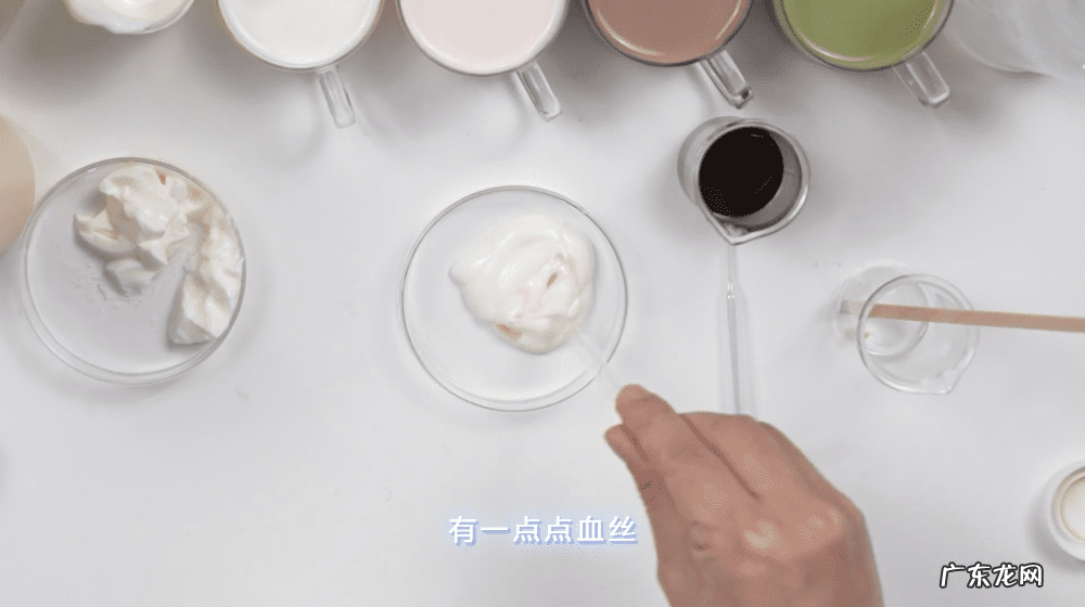 白色豆腐渣分泌物照片 白带