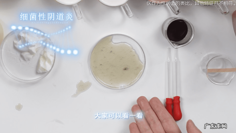 白色豆腐渣分泌物照片 白带