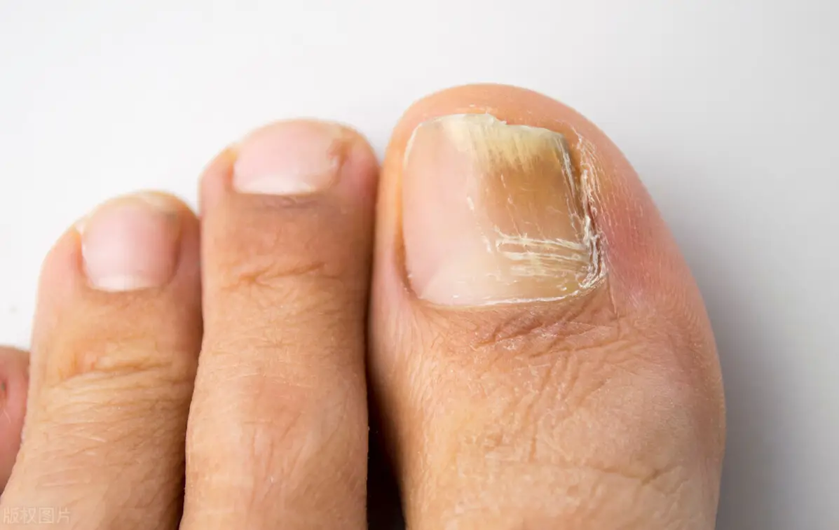 四物汤的功效与作用及禁忌 四物汤有什么组成