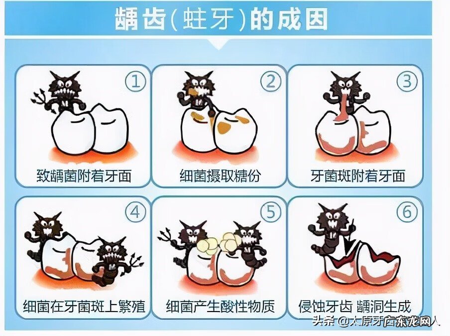 虫牙里面有虫吗 虫牙是真的有虫子吗