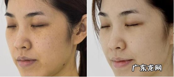 十大祛斑排行榜 最好的祛斑产品有哪些