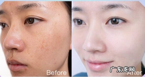 十大祛斑排行榜 最好的祛斑产品有哪些