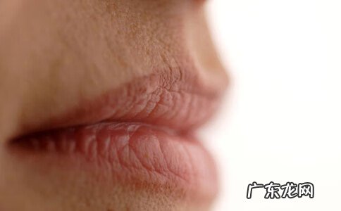 口角炎一般多久能好 口角炎是什么原因造成的