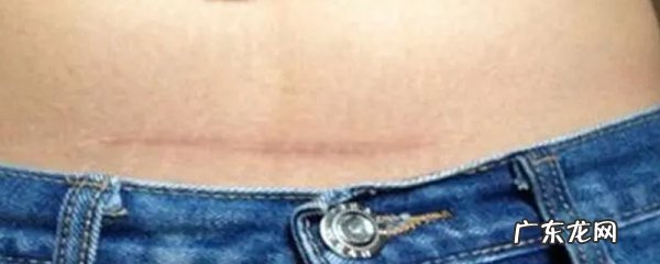 祛疤效果好的药膏，哪个牌子祛疤效果好