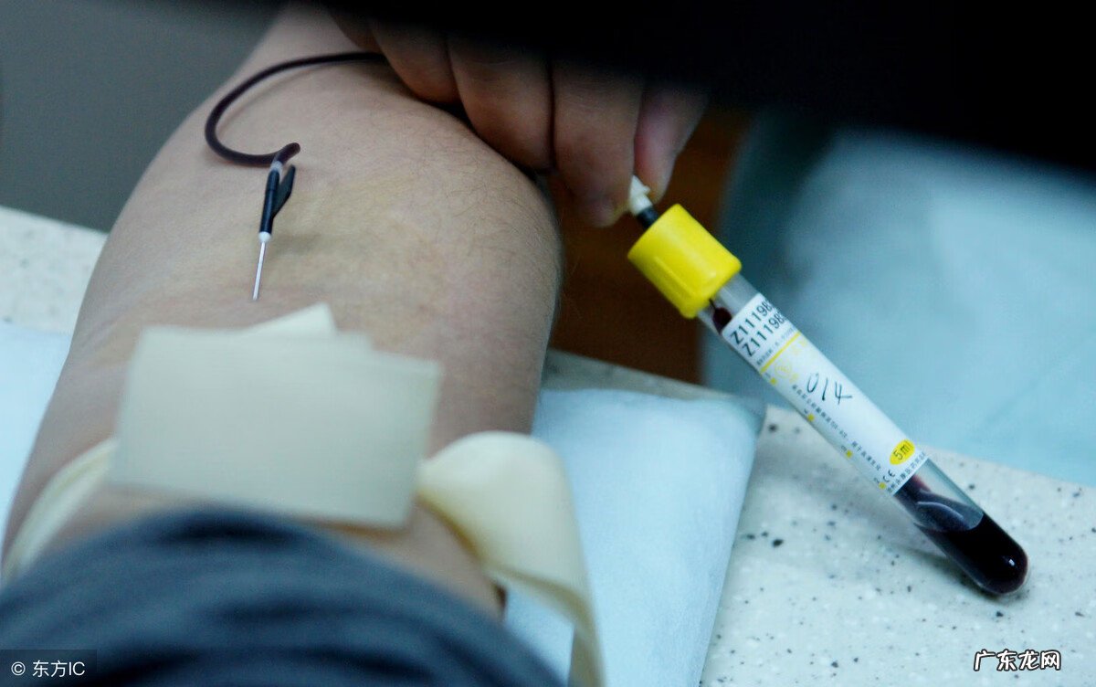 白细胞计数公式 白细胞计数12严重吗