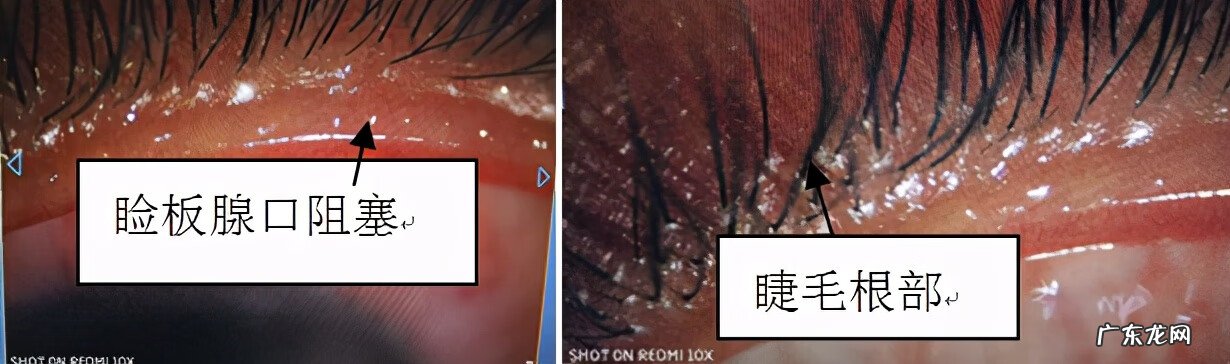 眼睛干涩酸疼 眼睛涩痛是什么原因