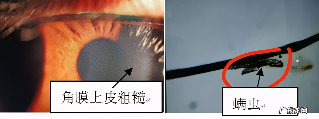 眼睛干涩酸疼 眼睛涩痛是什么原因