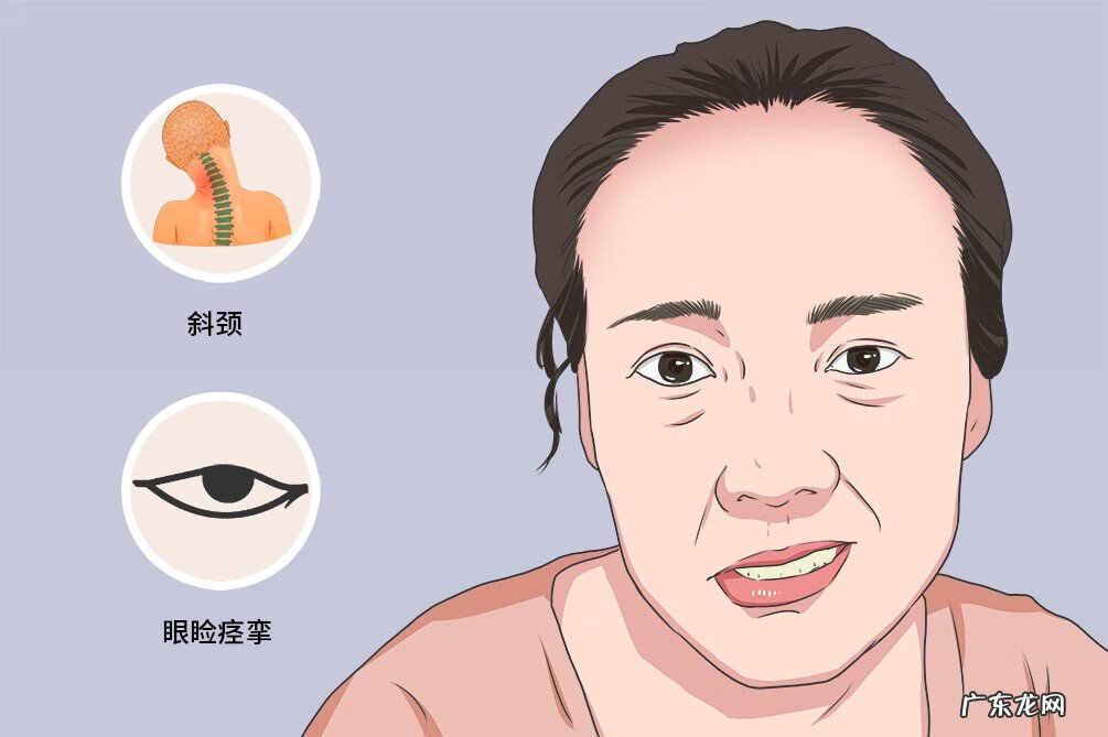 多系统萎缩的病因 多系统萎缩症是什么病