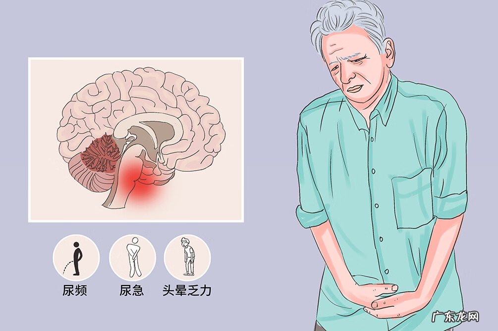 多系统萎缩的病因 多系统萎缩症是什么病