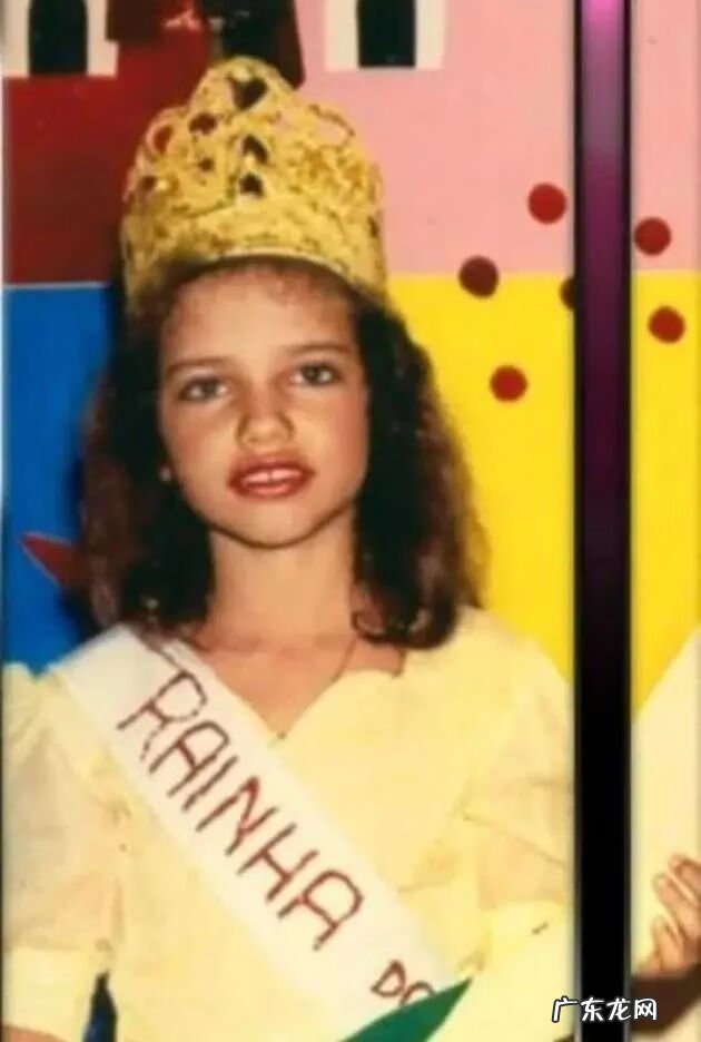 妊娠纹刚出来的样子 妊娠纹是什么样的图片