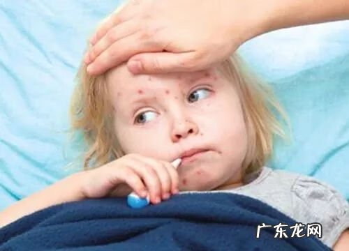 水痘凸起疤痕 水痘疤痕图片