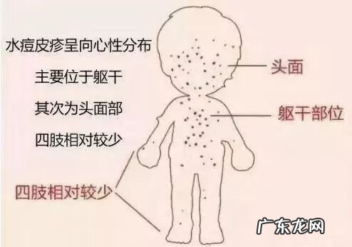 水痘凸起疤痕 水痘疤痕图片