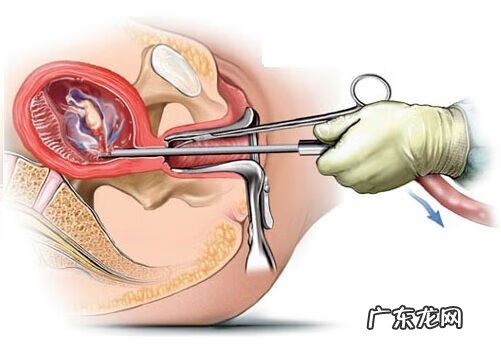 输卵管造影后多久可以同房要孩子 输卵管造影后多久可以同房?