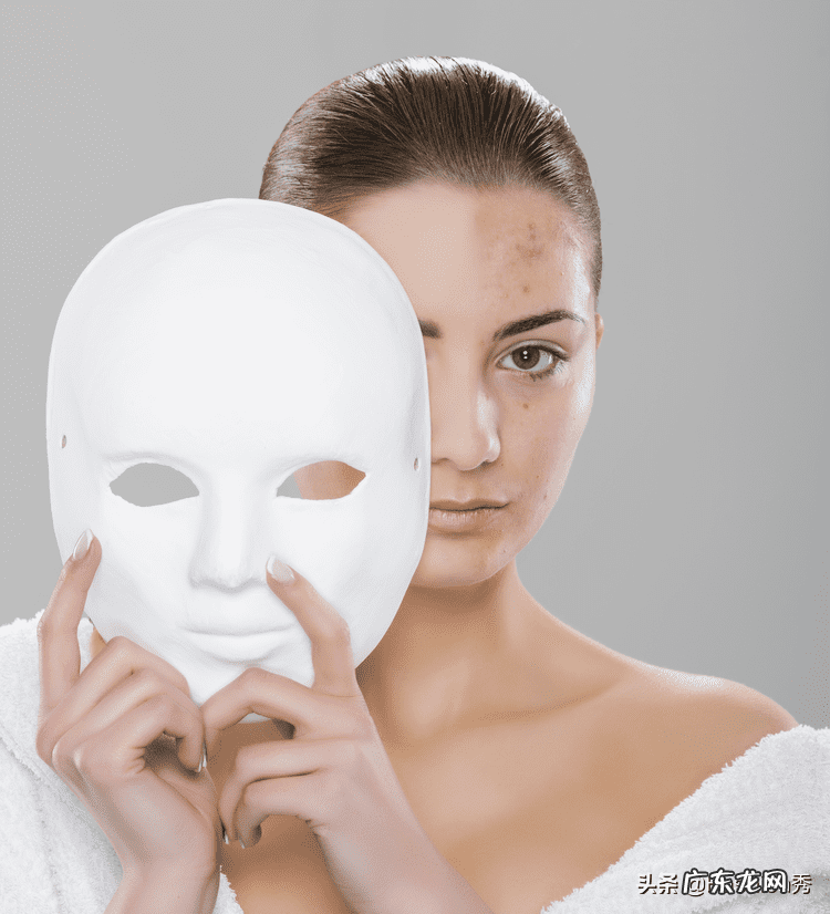 什么是暗疮 暗疮