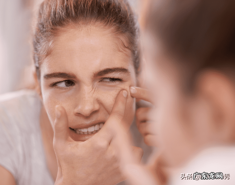 什么是暗疮 暗疮