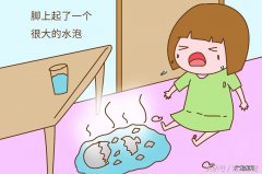 小孩被烫伤起泡了怎么办 小孩烫伤起泡怎么办?