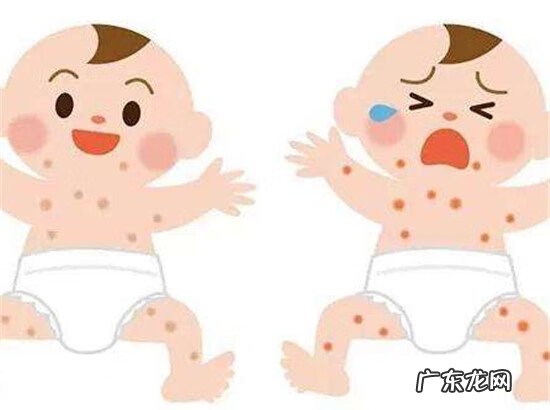 去除婴儿湿疹小妙招 婴儿湿疹图片