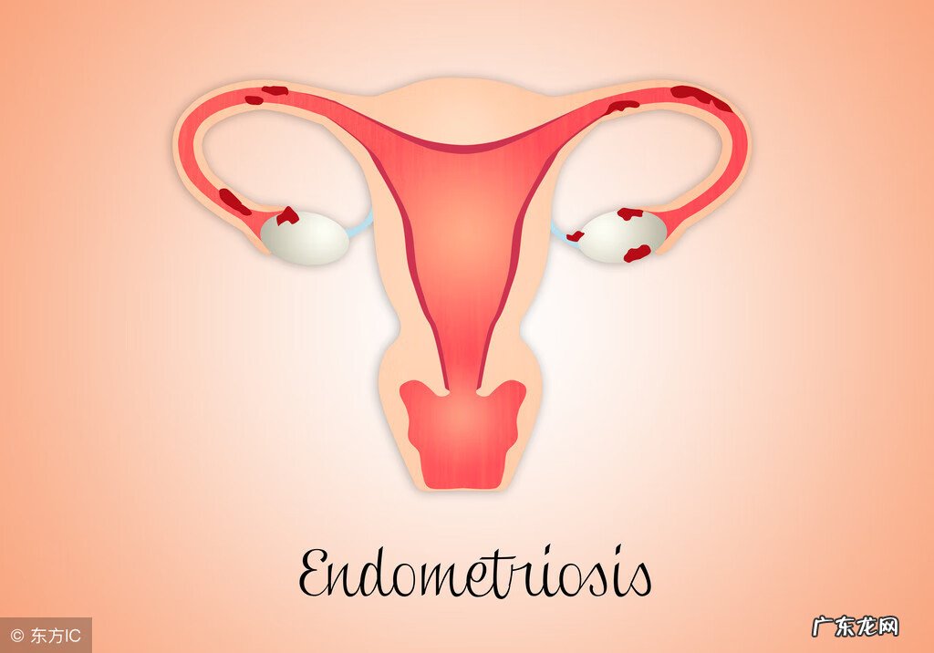 子宫内膜增厚有哪些症状表现 子宫内膜增厚的症状表现