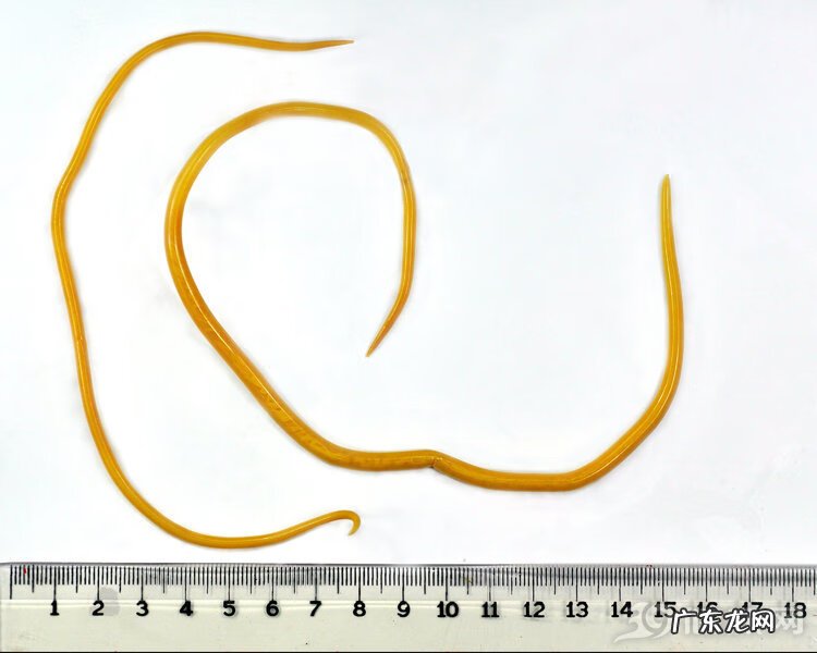 肛门老是瘙痒是怎么回事 肛门瘙痒是怎么回事儿