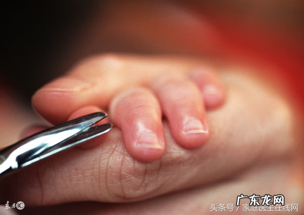 长倒刺怎么办 倒刺怎么处理