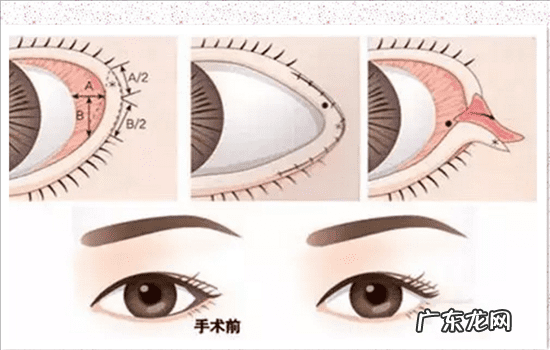 怎样可以使眼睛变大 眼睛怎样才能变大?