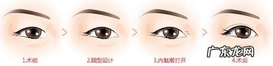 怎样可以使眼睛变大 眼睛怎样才能变大?