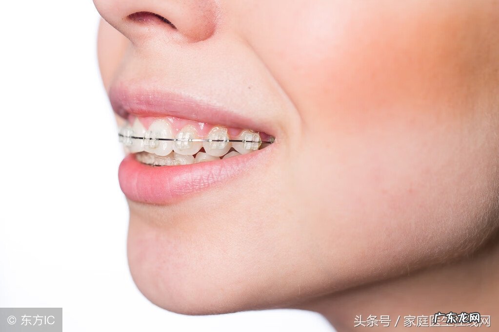 地包天怎么办 地包天怎么纠正