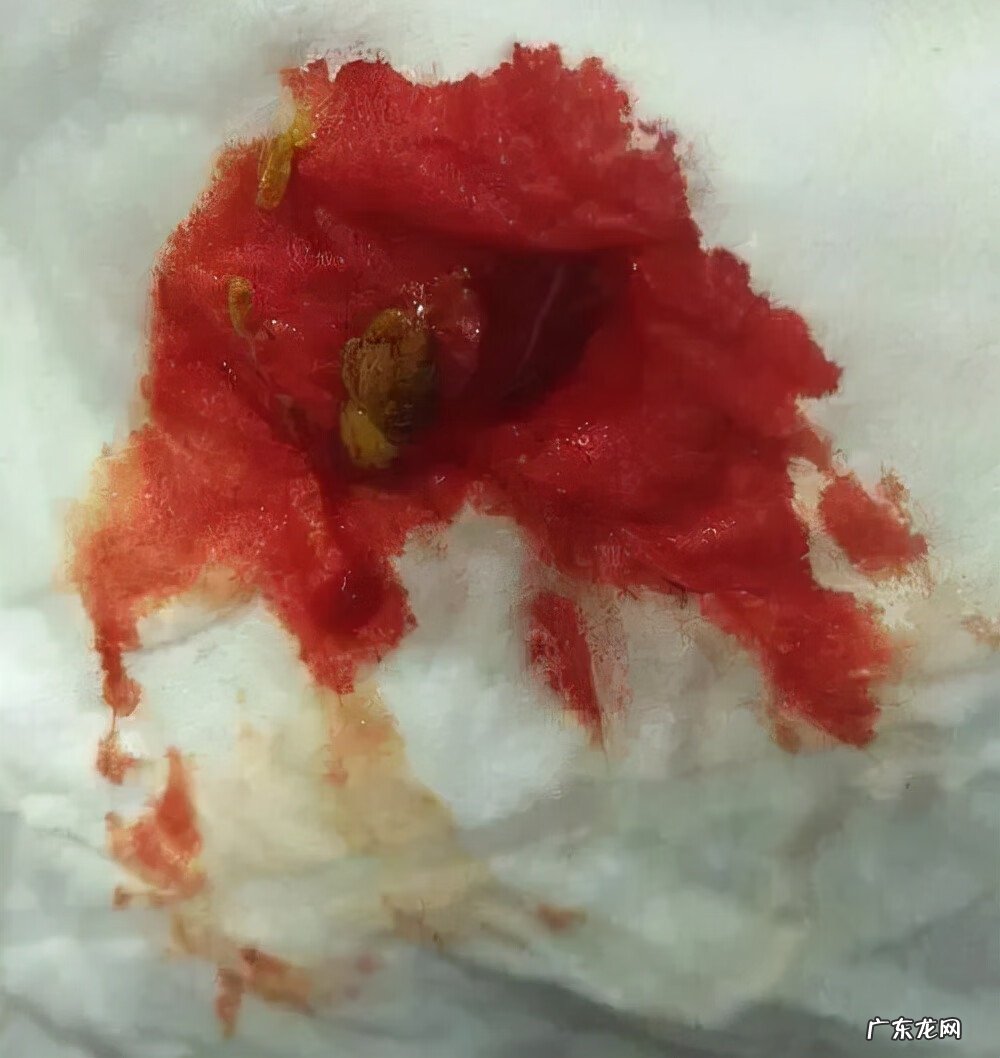 7个月宝宝拉肚子怎么回事 七个月宝宝腹泻是什么原因引起的