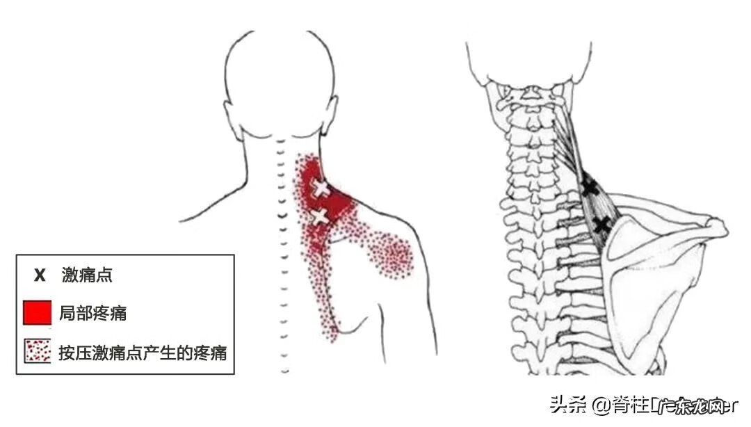 右肩膀酸痛怎么办 右肩膀酸痛是怎么回事