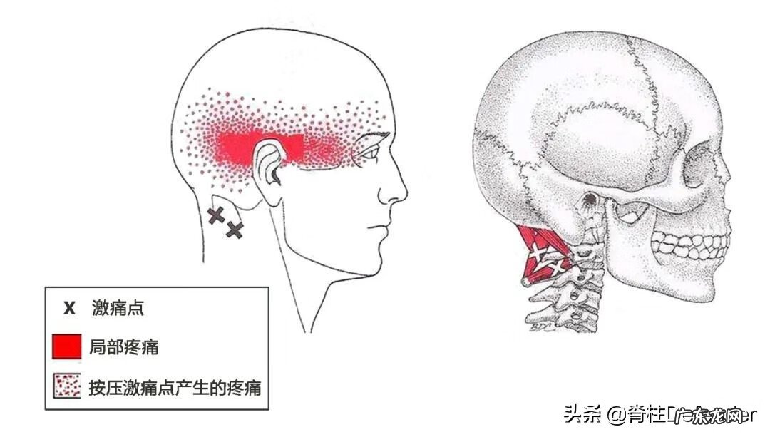右肩膀酸痛怎么办 右肩膀酸痛是怎么回事