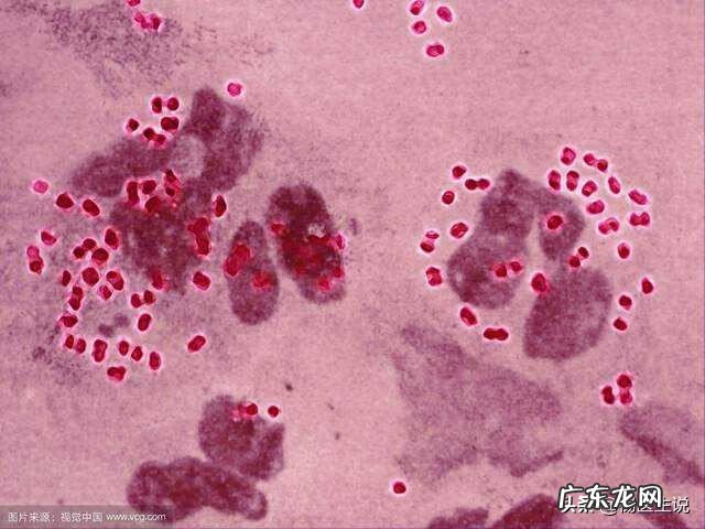 淋菌性尿道炎分泌物图片 淋菌性尿道炎是怎么感染的