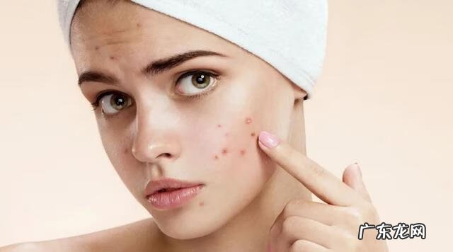 如何正确去痘痘 祛痘美白什么产品好