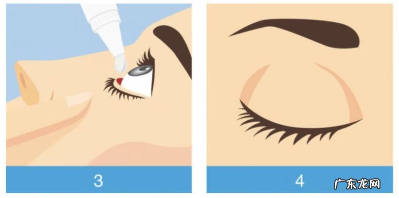 缓解视力疲劳的眼药水 眼药水的正确滴法