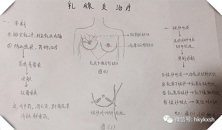 乳腺炎怎么调理最好方法 急性乳腺炎怎么办