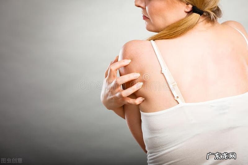 面部湿疹是什么原因造成的 面部湿疹症状是什么