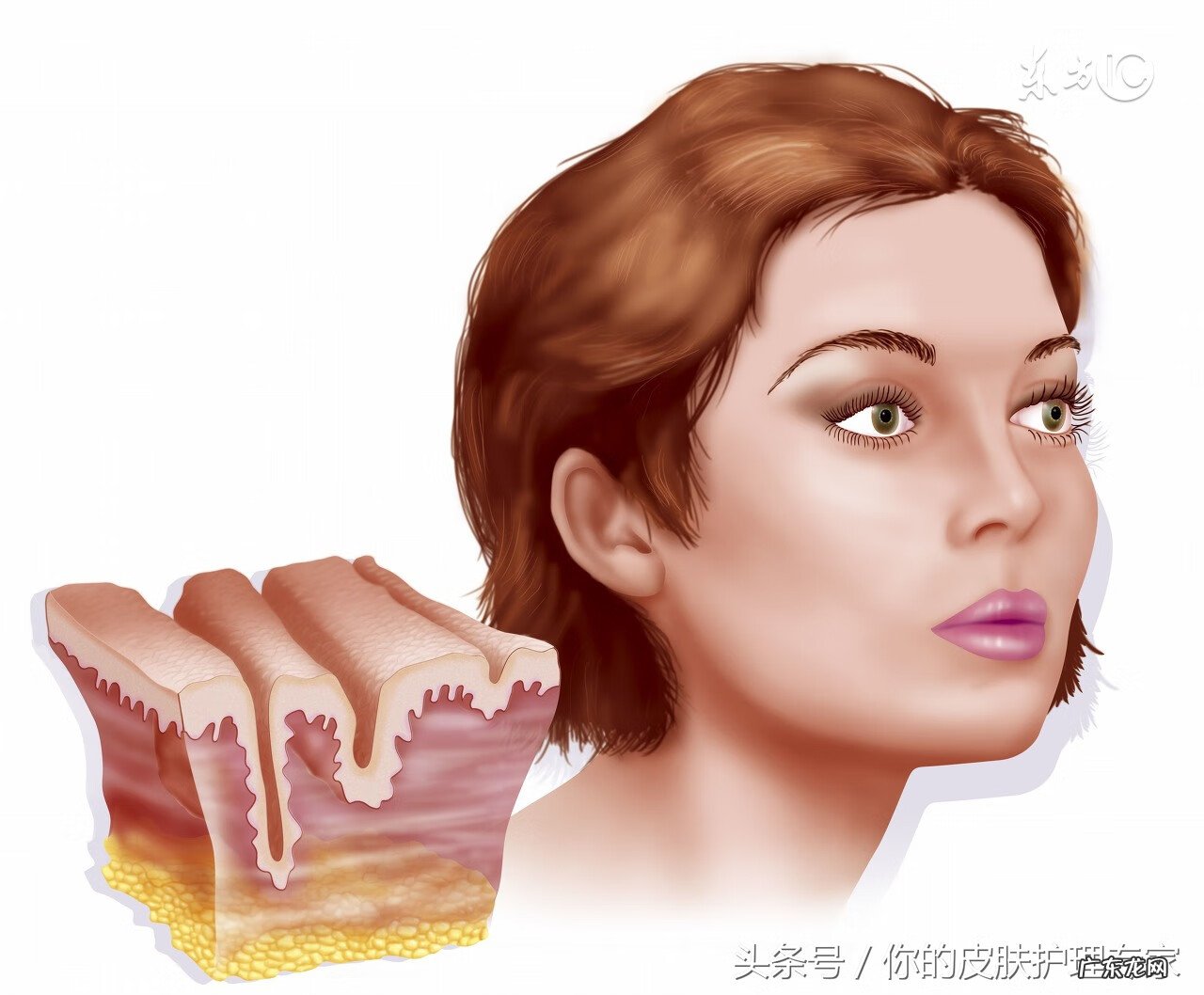 油性皮肤的美容护理方案 油性皮肤护理方法