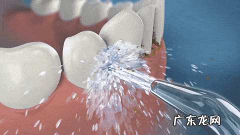 洗牙痛不痛,难不难受 洗牙疼吗什么感觉