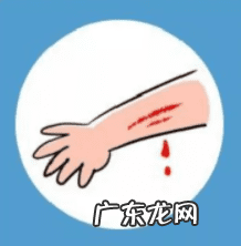 狗给我咬起包了没出血 被小狗咬了没出血