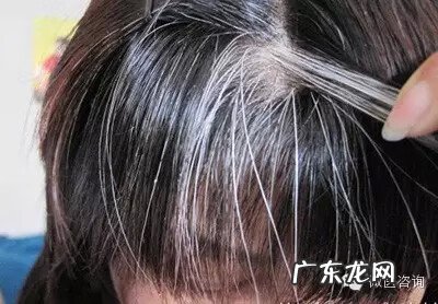 不长白头发的人好吗 少年白头好吗