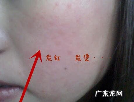 白醋洗脸有好处吗 白醋洗脸好吗?