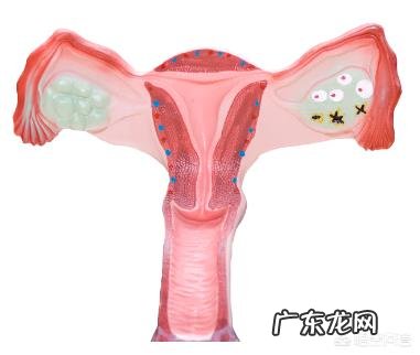 子宫息肉必须手术吗？