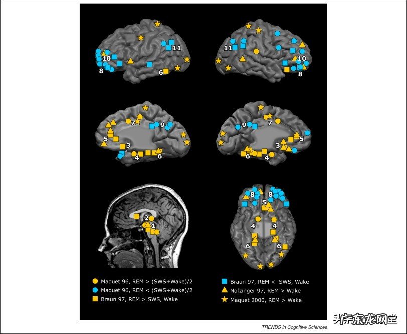 我每天晚上都做梦,每一个梦都不一样,梦里见过的人都不认识但是都面孔清晰,为什么?