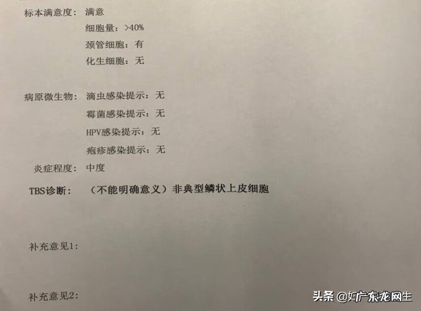 tct几种检查结果解读 tct检查结果有几种情况